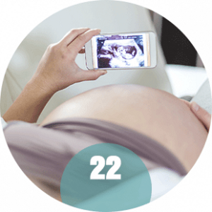22 tydzień ciąży - kobieta i usg 22 tydzień ciąży - kobieta i usg